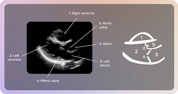 Schéma annoté des structures cardiaques visibles à l'échographie